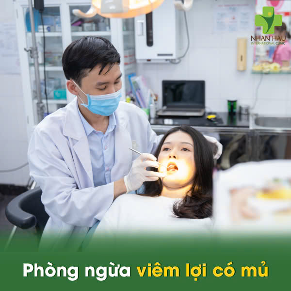 Viêm Lợi Có Mủ: Nguyên Nhân và Cách Điều Trị An Toàn 6 Phòng ngừa viêm lợi có mủ