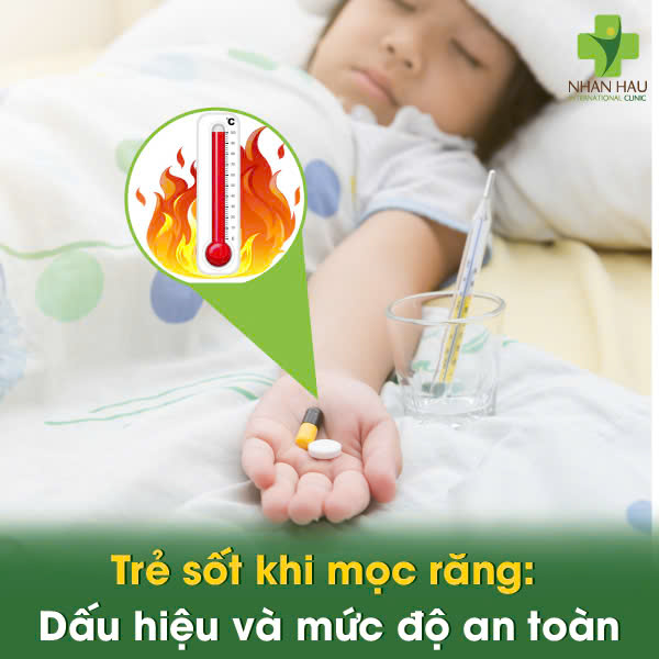 Trẻ Sốt Khi Mọc Răng: Lưu Ý Dấu Hiệu và Cách Hạ Sốt An Toàn 3 Trẻ sốt khi mọc răng: Dấu hiệu và mức độ an toàn