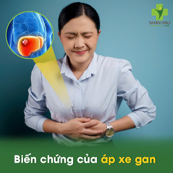 Áp xe gan: Nguyên Nhân, Triệu Chứng và Những biến chứng nguy hiểm 4 Biến chứng của áp xe gan