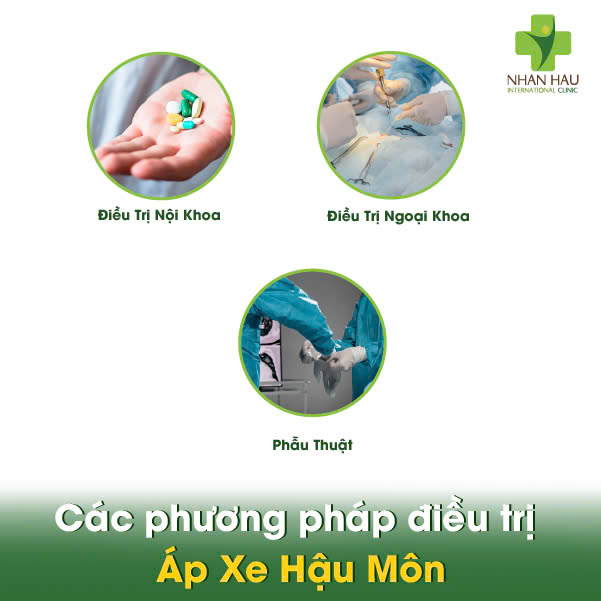 Áp Xe Hậu Môn: Triệu Chứng, Nguyên Nhân và Điều Trị 5 Các phương pháp điều trị Áp Xe Hậu Môn