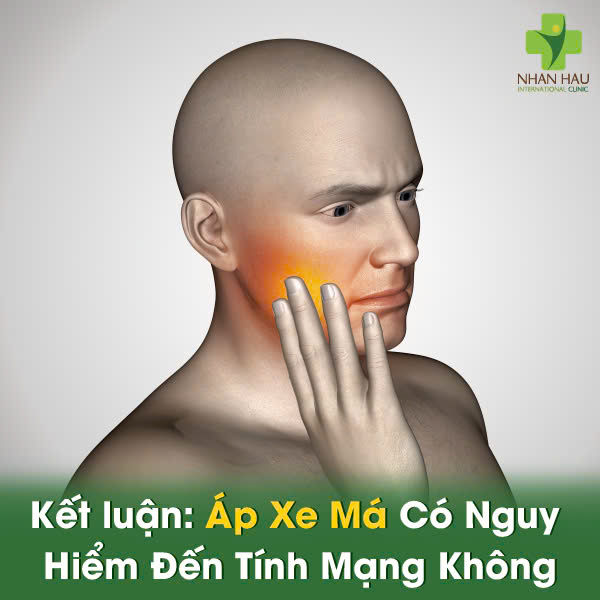 Áp Xe Má: Nhận Biết, Điều Trị, Phòng Ngừa 7 Kết luận: Áp Xe Má Có Nguy Hiểm Đến Tính Mạng Không