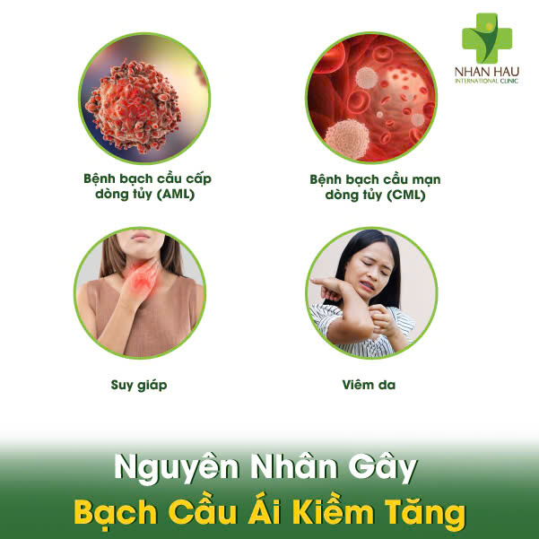Bạch Cầu Ái Kiềm Tăng: Nguyên Nhân và Điều Trị 2 Nguyên Nhân Gây Bạch Cầu Ái Kiềm Tăng