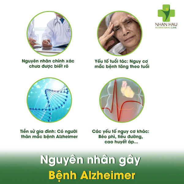 Bệnh Alzheimer: Dấu Hiệu, Nguyên Nhân và Cách Chăm Sóc Người Bệnh 3 Nguyên nhân gây Bệnh Alzheimer