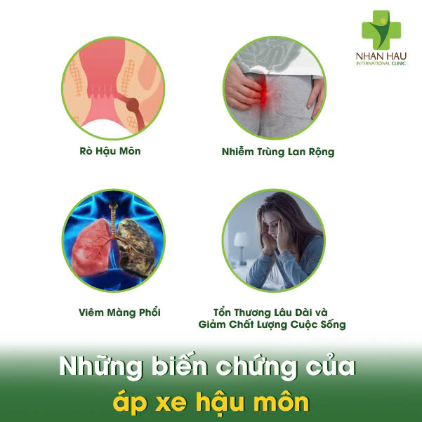 Áp Xe Hậu Môn: Triệu Chứng, Nguyên Nhân và Điều Trị 4 Những biến chứng của áp xe hậu môn