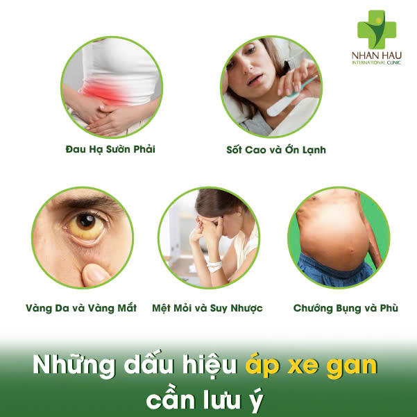 Áp xe gan: Nguyên Nhân, Triệu Chứng và Những biến chứng nguy hiểm 3 Những dấu hiệu áp xe gan cần lưu ý