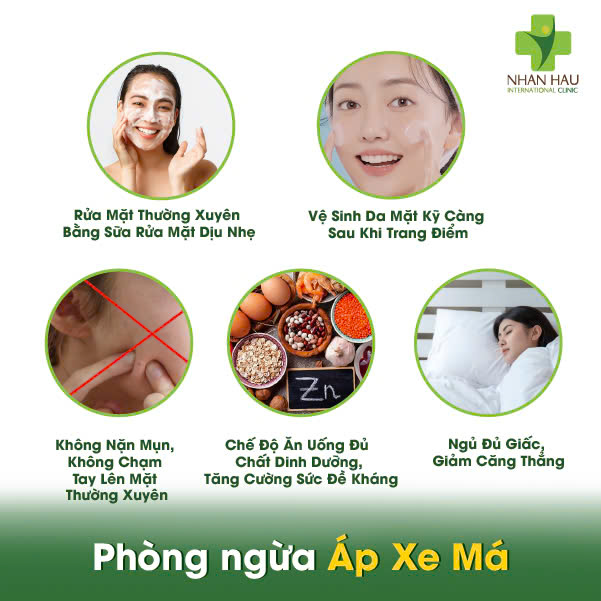 Áp Xe Má: Nhận Biết, Điều Trị, Phòng Ngừa 6 Phòng ngừa Áp Xe Má