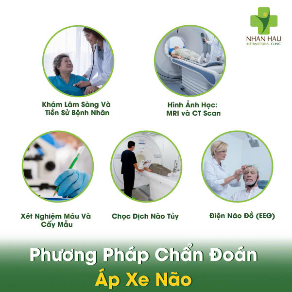 Áp Xe Não: Tình Trạng Nguy Hiểm - Cần Được Cấp Cứu Y Tế Ngay Lập tức 5 Phương Pháp Chẩn Đoán Áp Xe Não