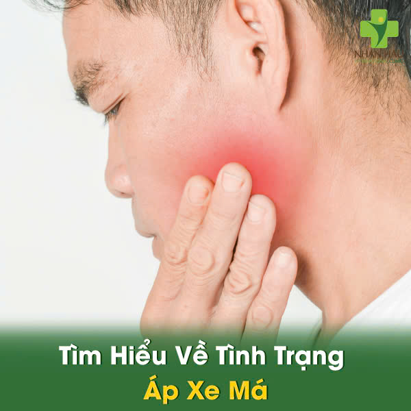 Áp Xe Má: Nhận Biết, Điều Trị, Phòng Ngừa 1 Tìm Hiểu Về Tình Trạng Áp Xe Má