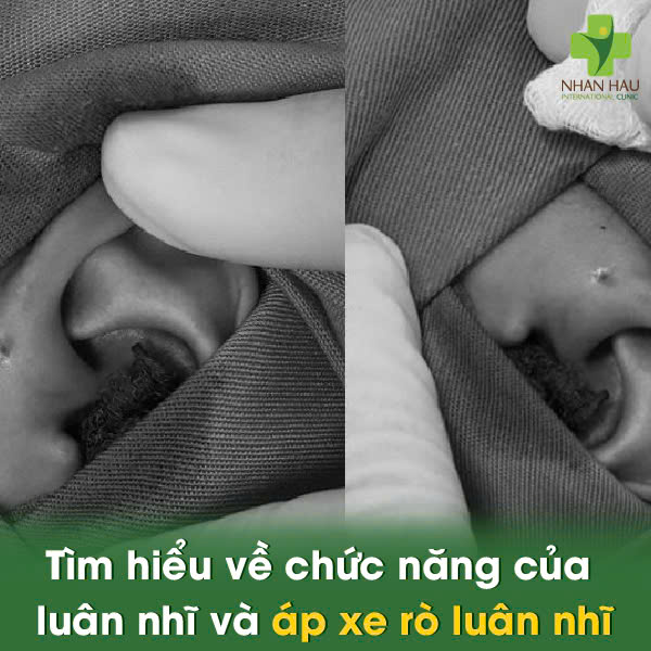 Áp Xe Phổi: Triệu Chứng, Nguyên Nhân và Điều Trị 1 Tìm hiểu về chức năng phổi và áp xe phổi