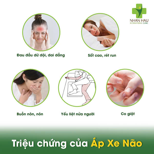 Áp Xe Não: Tình Trạng Nguy Hiểm - Cần Được Cấp Cứu Y Tế Ngay Lập tức 2 Triệu Chứng Của Áp Xe Não