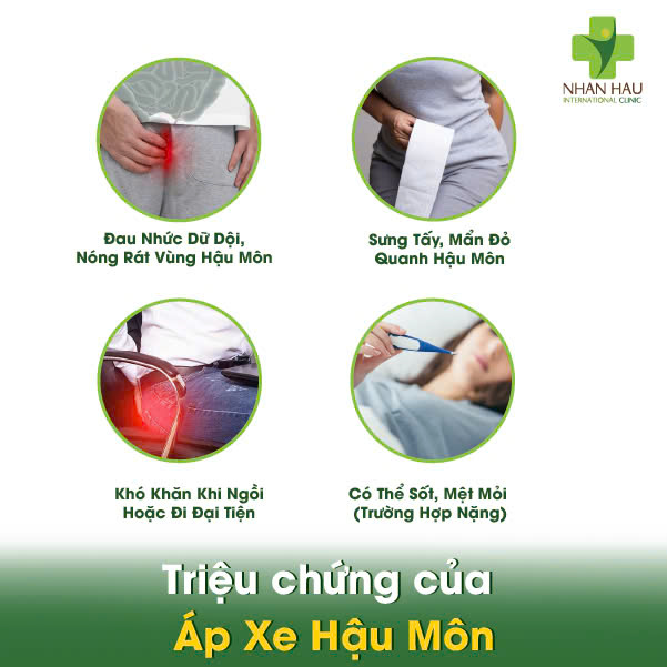 Áp Xe Hậu Môn: Triệu Chứng, Nguyên Nhân và Điều Trị 2 Triệu chứng của Áp Xe Hậu Môn