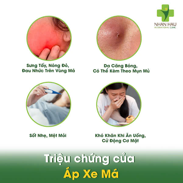 Áp Xe Má: Nhận Biết, Điều Trị, Phòng Ngừa 2 Triệu chứng của Áp Xe Má