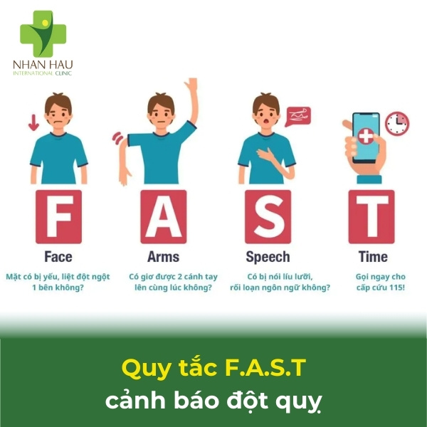 Giờ Vàng Trong Tai Biến Mạch Máu Não: Cấp Cứu Ngay Để Cứu Sống 2 Quy tắc FAST cảnh báo đột quỵ
