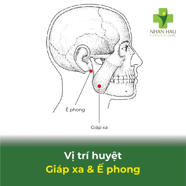 Cách bấm huyệt cho người bị tai biến mạch máu não 8 vị trí huyệt giáp xa & ế phong