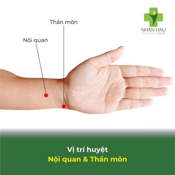 Cách bấm huyệt cho người bị tai biến mạch máu não 6 vị trí huyệt nội quan, thần môn