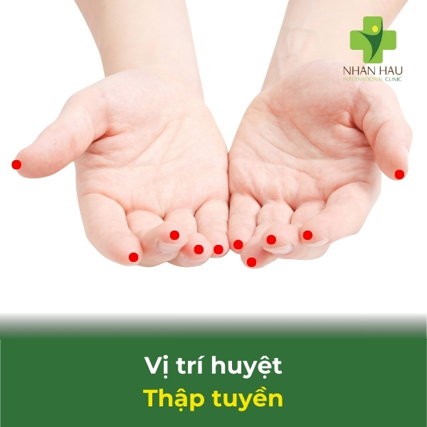 Cách bấm huyệt cho người bị tai biến mạch máu não 2 vị trí huyệt thập tuyền