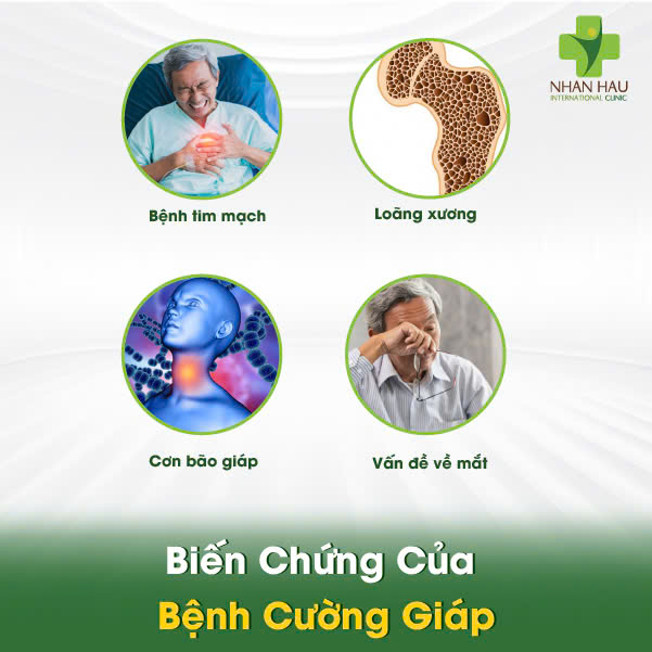 Bệnh Cường Giáp: Nguyên Nhân, Triệu Chứng và Điều Trị Hiệu Quả 4 Biến Chứng Của Bệnh Cường Giáp