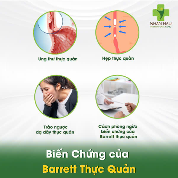 Barrett thực quản: Nguyên nhân, Triệu chứng và Cách Kiểm soát 4 Biến Chứng của Barrett Thực Quản