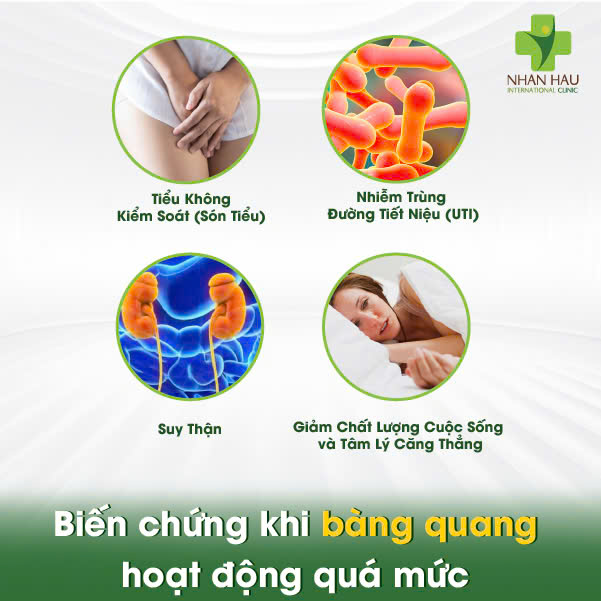 Bàng Quang Hoạt Động Quá Mức: Nguyên Nhân, Triệu Chứng và Cách Kiểm Soát 4 Biến chứng khi bàng quang hoạt động quá mức nhưng không được điều trị