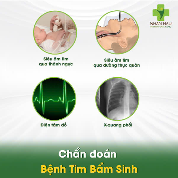 Bệnh Tim Bẩm Sinh: Nguyên nhân, triệu chứng và cách phát hiện 5 Chẩn đoán Bệnh Tim Bẩm Sinh