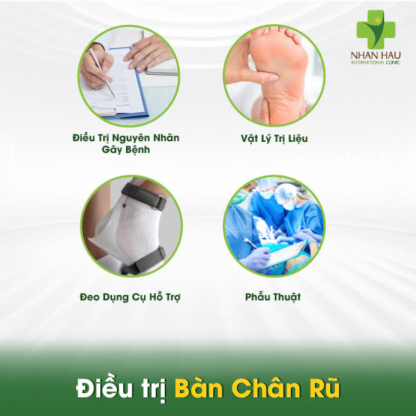 Bàn Chân Rũ: Nguyên Nhân, Triệu Chứng và Điều Trị Hiệu Quả 5 Điều trị Bàn Chân Rũ