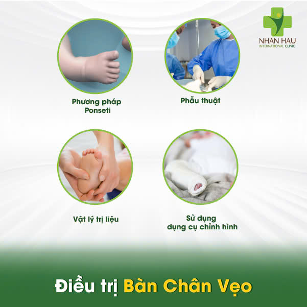 Bàn Chân Vẹo: Nguyên Nhân, Dấu Hiệu và Điều Trị Hiệu Quả 5 Điều trị Bàn Chân Vẹo