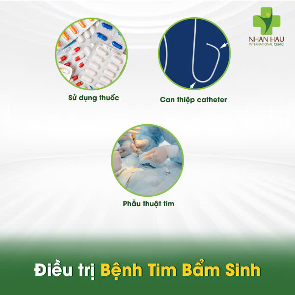 Bệnh Tim Bẩm Sinh: Nguyên nhân, triệu chứng và cách phát hiện 6 Điều trị Bệnh Tim Bẩm Sinh