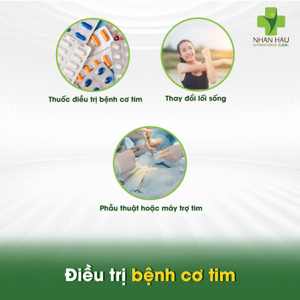 Nhận Diện Các Dạng Bệnh Cơ Tim: Nguyên Nhân, Triệu Chứng và Điều Trị 5 Điều trị bệnh cơ tim