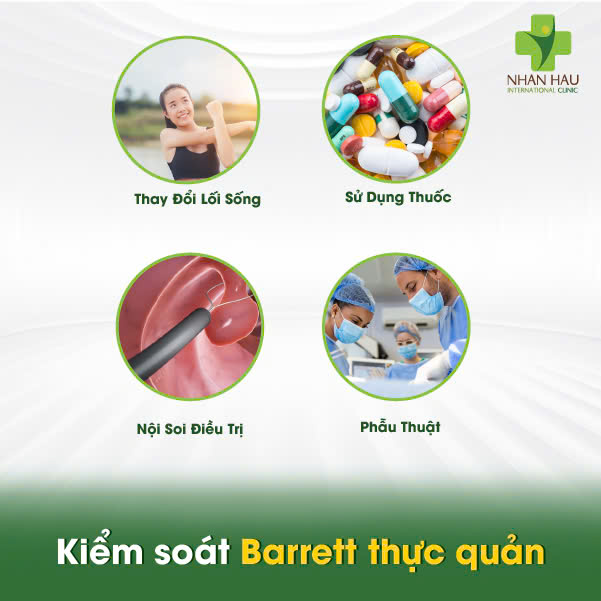 Barrett thực quản: Nguyên nhân, Triệu chứng và Cách Kiểm soát 6 Kiểm soát Barrett thực quản