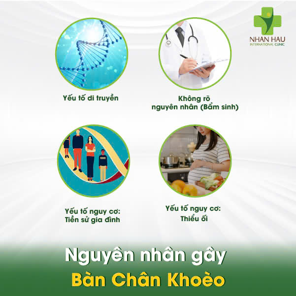 Bàn Chân Khoèo: Nguyên Nhân, Dấu Hiệu và Điều Trị Hiệu Quả 2 Nguyên nhân gây Bàn Chân Khoèo