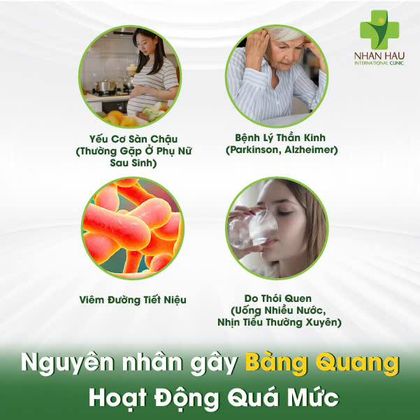 Bàng Quang Hoạt Động Quá Mức: Nguyên Nhân, Triệu Chứng và Cách Kiểm Soát 2 Nguyên nhân gây Bàng Quang Hoạt Động Quá Mức