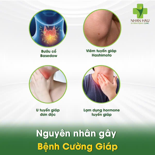 Bệnh Cường Giáp: Nguyên Nhân, Triệu Chứng và Điều Trị Hiệu Quả 2 Nguyên nhân gây Bệnh Cường Giáp