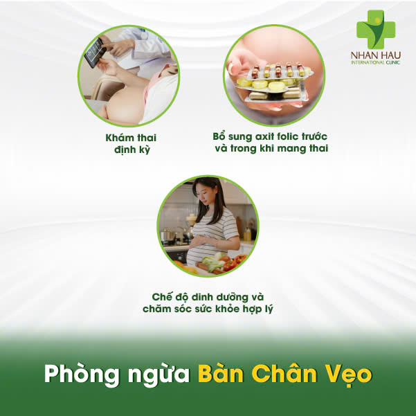 Bàn Chân Vẹo: Nguyên Nhân, Dấu Hiệu và Điều Trị Hiệu Quả 6 Phòng ngừa Bàn Chân Vẹo