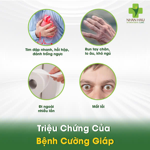 Bệnh Cường Giáp: Nguyên Nhân, Triệu Chứng và Điều Trị Hiệu Quả 3 Triệu Chứng Của Bệnh Cường Giáp