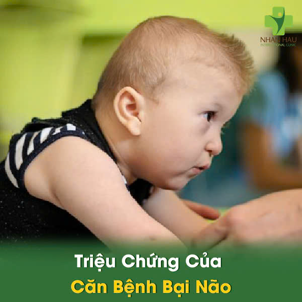 Bại Não: Nguyên Nhân, Triệu Chứng Và Những Biên Chứng 2 Triệu Chứng Của Căn Bệnh Bại Não