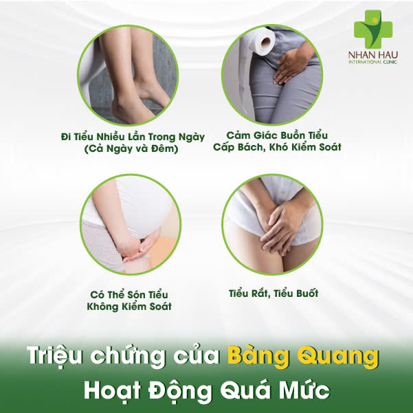 Bàng Quang Hoạt Động Quá Mức: Nguyên Nhân, Triệu Chứng và Cách Kiểm Soát 3 Triệu chứng của Bàng Quang Hoạt Động Quá Mức