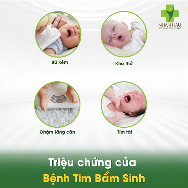 Bệnh Tim Bẩm Sinh: Nguyên nhân, triệu chứng và cách phát hiện 4 Triệu chứng của Bệnh Tim Bẩm Sinh
