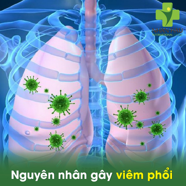 Nguyên nhân gây ra viêm phổi
