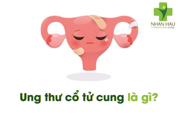 ung thư cổ tử cung là gì
