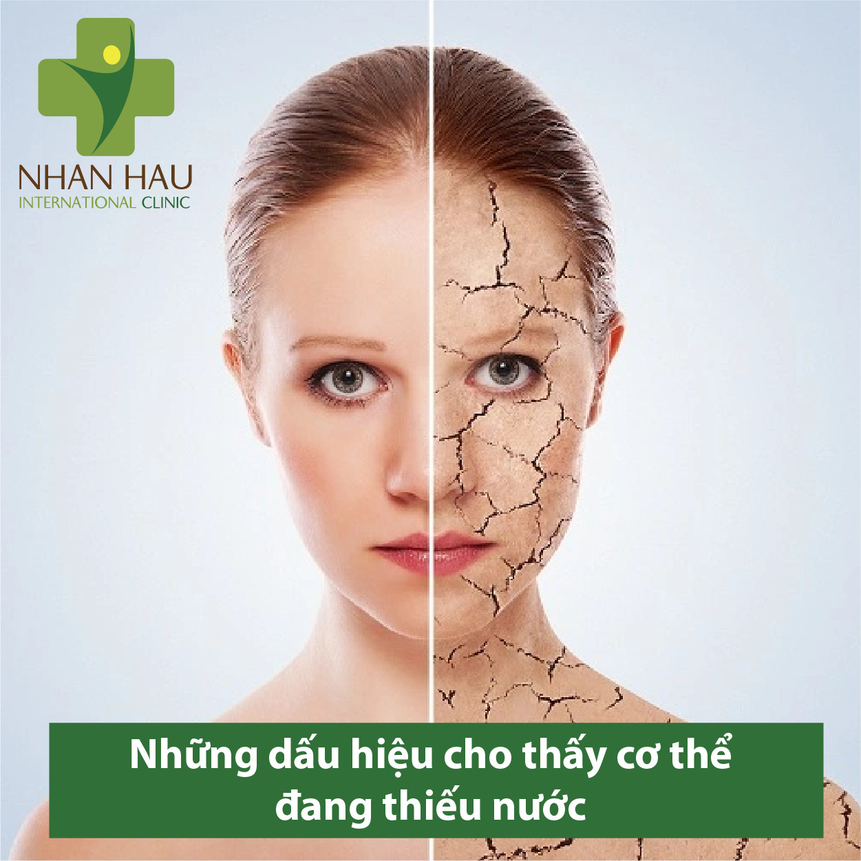 Những dấu hiệu cho thấy cơ thể thiếu nước