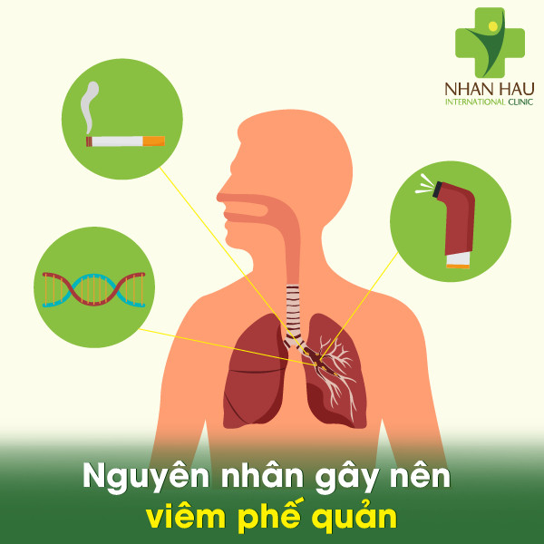 Nguyên nhân gây nên viêm phế quản