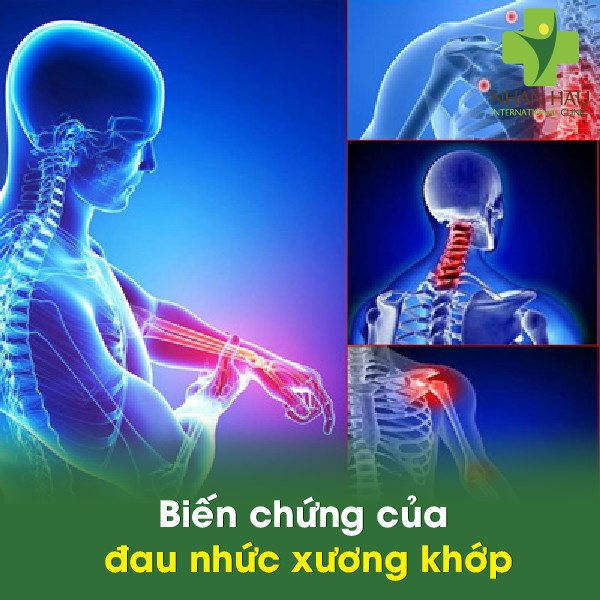 Biến chứng của đau nhức xương khớp