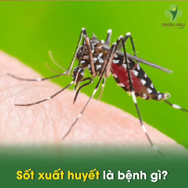 Sốt xuất huyết là bệnh gì