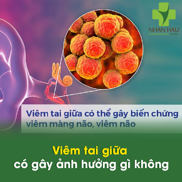 Viêm tai giữa có gây ảnh hưởng gì không