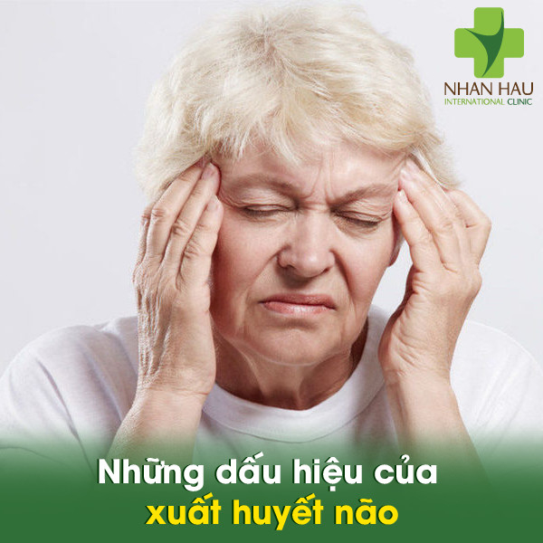 Những dấu hiệu của xuất huyết não