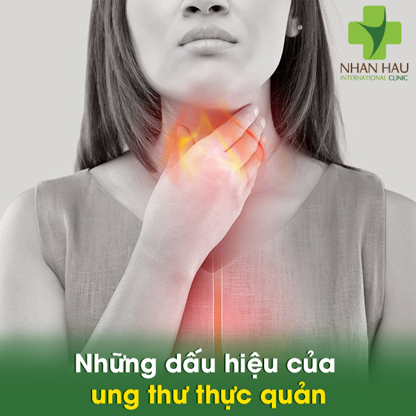 Những dấu hiệu của ung thư thực quản