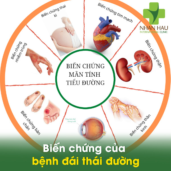 Biến chứng của bệnh đái thái đường