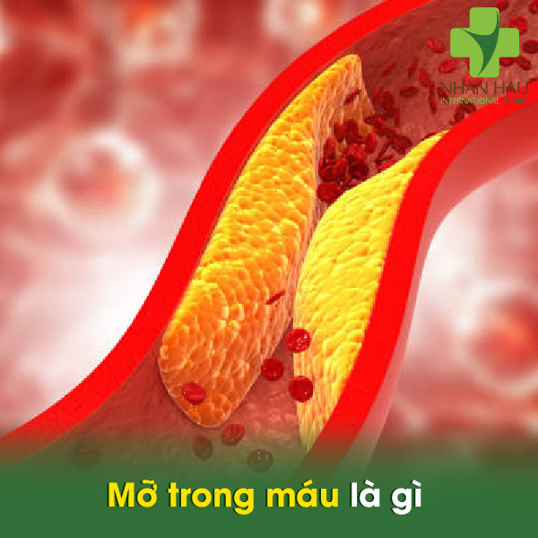 Mỡ trong máu là gì