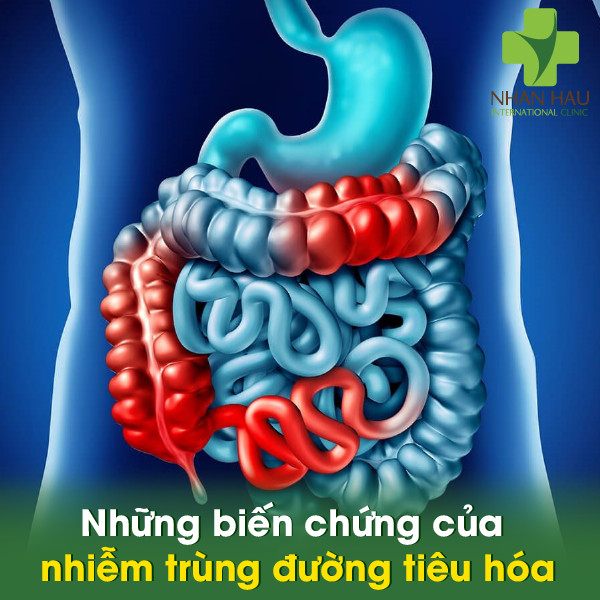 Những biến chứng của nhiễm trùng đường tiêu hóa