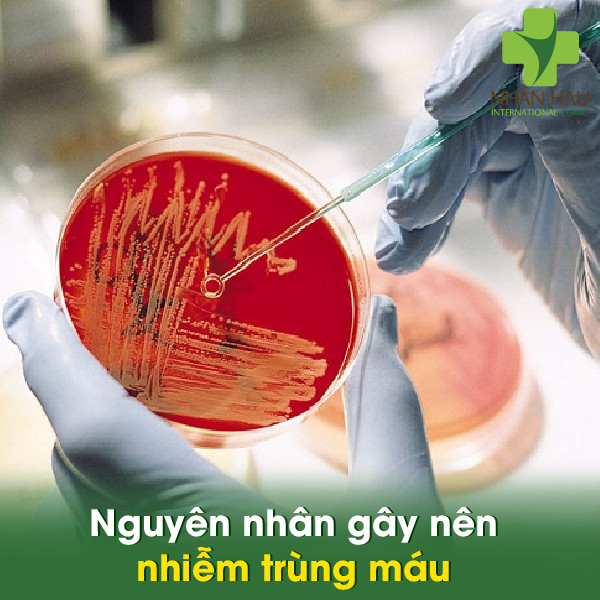 Nguyên nhân gây nên nhiễm trùng máu